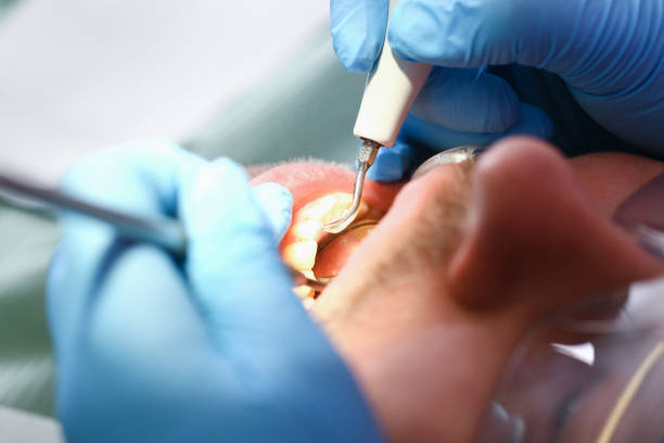 Best Emergency Dental Surgery in Forestde, AL