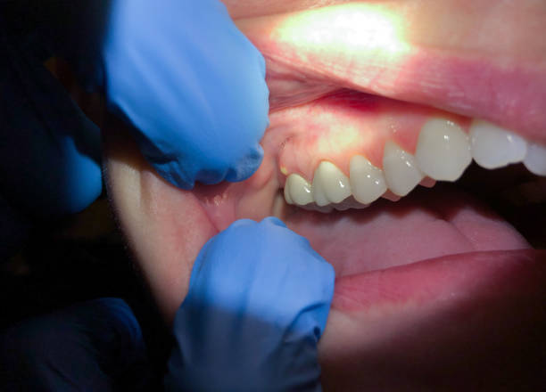Best After-Hours Emergency Dentist in Forestde, AL